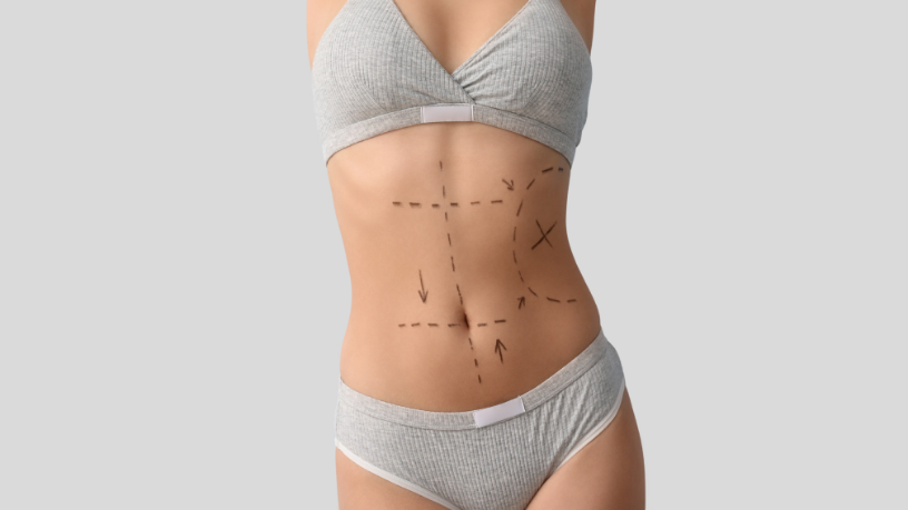 O pré-operatório na cirurgia plástica garante resultados melhores e recuperação segura, afirma Dr. Gilberson Wanderley Silva.